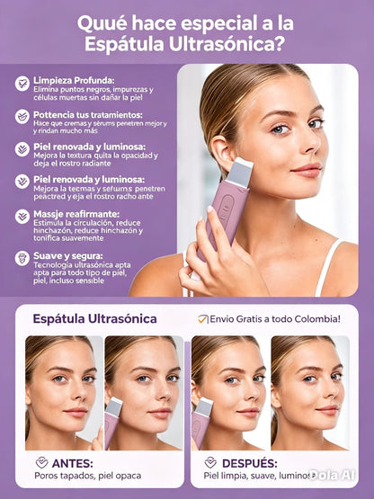 ESPÁTULA ULTRACLEAN + ENVÍO GRATIS.
